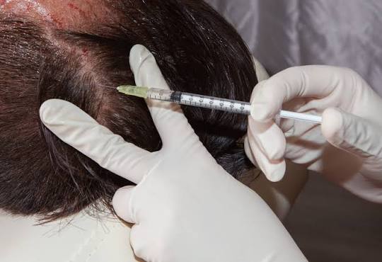 Hair Regrowth Solutions