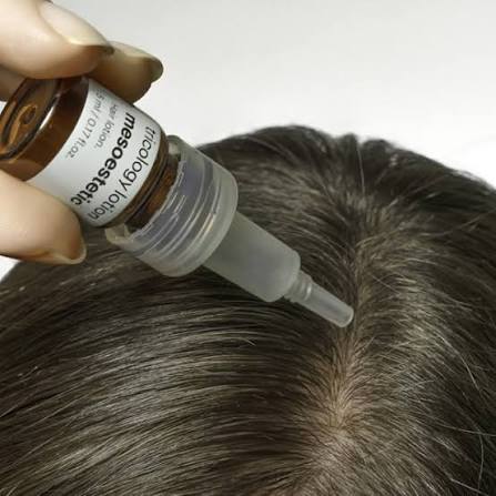 mesotherapy